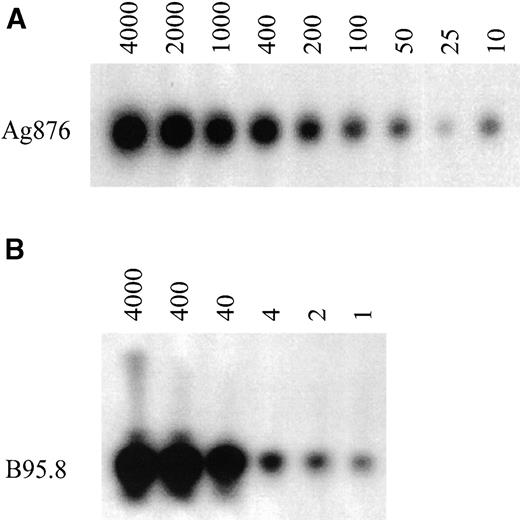 Fig. 1. Sensitivity of the nested PCR for EBV-typing on PBMC. PCR analysis was performed on sequential dilutions of the EBV-positive cell lines, B95.8 and Ag876. (A) Dilution of Ag876 (number of cells) in a total of 2 × 105 EBV-negative background cells and (B) dilution of B95.8 (number of cells) in a total of 2 × 105EBV-negative background cells.