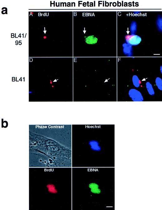Fig. 2. (a) Presence of apoptotic bodies in HF cells after 1 week of cocultivation. The EBV-positive BL41/95 (A through C) and -negative BL41 (D through F) were labeled for 48 hours with BrdU before irradiation and cultivation with HF cells. DNA from the lymphomas was detected with antibodies against BrdU (A and D). Cells were double-stained with human serum against EBV nuclear antigens (EBNA; B and E). (C) and (F) show Hoechst 33258, anti-EBNA, and anti-BrdU stainings in the same picture. Size bar = 5 μm. (b) Fibroblasts pulsed with BrdU before being cultivated with irradiated BL41/95 cells. Nuclei of fibroblastic origin were detected with antibodies against BrdU. Cells were double-stained with human serum against EBNAs. The picture shows overlapping signals of EBNA, BrdU, and Hoechst 33258 staining in fibroblast nuclei. Size bar = 8 μm.