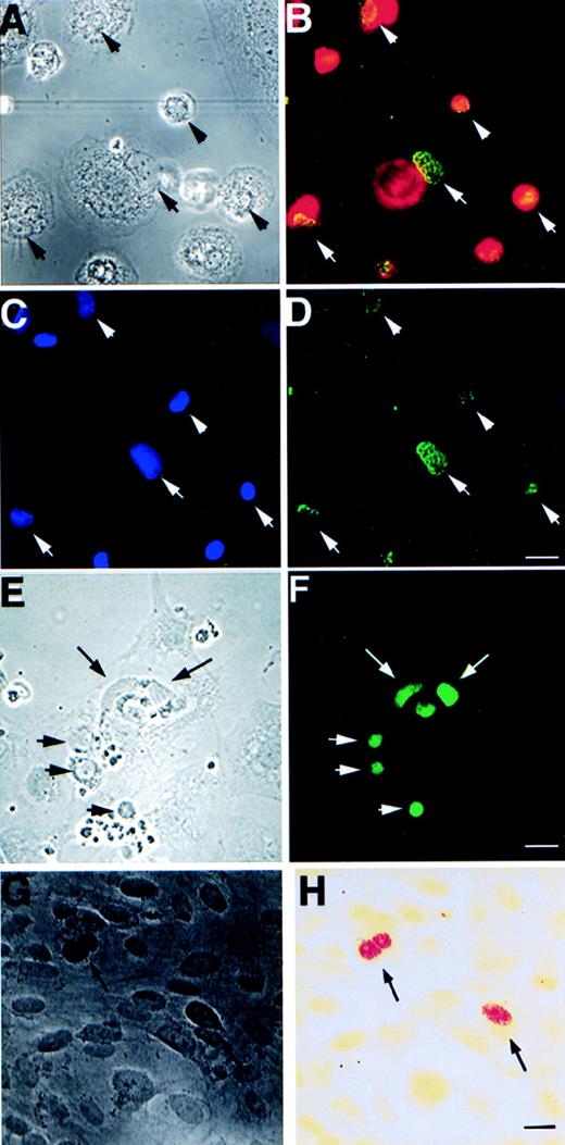 Fig. 3. Expression of EBV-specific genes, EBER1+2 and EBNA1-6, in different cell types after 3 weeks of cultivation with apoptotic bodies from EBV-carrying Namalwa line. (A) Phase contrast and (B) immunofluorescence staining showing coexpression of macrophage-specific marker CD68 (red) and EBNA (green) in the same cells. (C) shows the location of macrophage nuclei by Hoechst 33258 DNA staining that overlap with EBNA as shown in (D). Arrows mark the location of the nuclei that are located in the periphery of the cytoplasm of the macrophages. (E) Phase contrast and (F) fluorescence showing EBNA expression in bovine aortic endothelial cells. (G) Phase contrast and (H) bright field view of in situ hybridization analysis of EBER1 and 2 expression in HF cells. Arrows depict positive nuclei. Size bar = 20 μm.
