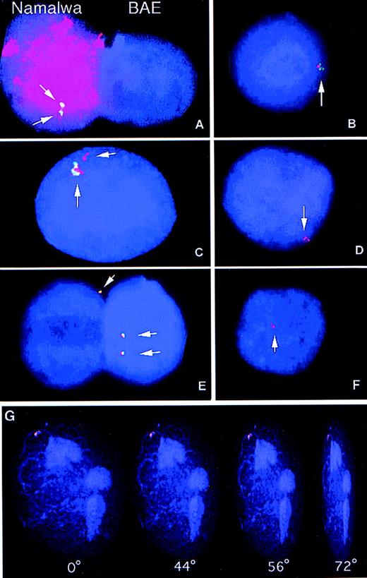 Fig. 4. Samples were hybridized with the BamHI W fragment of EBV, a sequence approximately 3-kb long that is repeated 6 to 10 times in the EBV genome. After hybridization, the biotinylatedBamHI W probe was detected using the fluorescein-conjugated avidin-biotin amplification system (green signals). Human total genomic DNA was directly labeled with tetra-methyl-rhodamine-dUTP (red signal). The presence of yellow signals indicated overlap of the human and the EBV probes. Nuclei were counterstained with the DNA fluorochrome, DAPI (blue). Digital images were captured in gray scale and subsequently pseudo-colored using computer imaging software. (A) Namalwa (left) and BAE nuclei (right) hybridized simultaneously with the EBV BamHI W probe (green) and human genomic DNA probe (red). The Namalwa nucleus shows two distinct signals with the EBV probe and uniform hybridization with the human probe, whereas the bovine nucleus was negative for both probes. (B through E) These figures show four examples from the two-color FISH analysis of the presence of human genomic DNA (red) and EBV-DNA (green) in BAE cells cultured with irradiated Namalwa cells for 1 week. Yellow signals indicate overlap of the signals from the EBVBamHI W and the human probes. (F) Simultaneous analysis of presence of EBV-DNA and human DNA in a BAE nucleus after cultivation with the EBV-negative cell line BL41 shows the presence of human DNA but not of EBV DNA in the BAE nucleus. (G) BAE nucleus cultured with irradiated Namalwa cells showing uptake of human DNA (red). A positive signal was analyzed by digital confocal microscopy. Images were sampled in the z-axis and subsequently processed with 3-D rendering software (Openlab) to generate three-dimensional pictures. The nuclei and incoming DNA could be viewed at different angles (0°, 44°, 56°, and 72°) and depths that showed that the positive signal was localized within the nuclear cage.