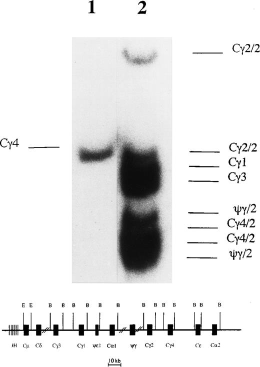 Fig. 1. Southern blot analysis to detect class switch recombination in L1236 cells. (Upper part) After digestion of genomic DNA with BamHI, the organization of the Cγ genes was analyzed in L1236 cells (lane 1) in comparison with the HD-derived cell line Co (lane 2) known to have germline configuration of the Cγ genes.20 The Cγ probe used in the analysis recognizes all Cγ genes and the ψγ gene. As expected, the DNA of Co shows all germline fragments for the IgG subclasses. The two IgH loci located on the two chromosomes 14 show a polymorphism for the pseudo Cγ (ψγ), the Cγ2, and the Cγ4 genes resulting in two fragments for these (indicated as /2), whereas only one fragment appears for Cγ1 and Cγ3 each. This pattern is in accordance with the results described by Linsley et al.21 For L1236 DNA, only one fragment is detectable, indicating that on one allele class switch recombination was targeted to the most 3′ γ gene (ie, Cγ4), whereas on the other allele all Cγ genes were deleted. (Lower part) Map of the human IgH locus. This map does not take into account the different haplotypes for the ψγ, the Cγ2, and the Cγ4 genes and is not to scale. B, BamHI; E, EcoRI.