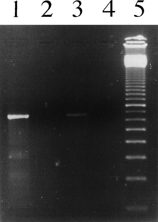Fig. 3. PCR analysis to detect IgH transcripts in L1236 cells as well as in H-RS cells of the patient’s affected bone marrow. Lane 1, L1236 cDNA; lane 2, L1309 cDNA; lane 3, section of the HD-affected bone marrow, cDNA; lane 4, no template; lane 5, 100-bp ladder. Using an oligonucleotide hybridizing to the CDRII of the VH1 gene rearrangement in L1236 cells in combination with an oligonucleotide hybridizing to the second exon of all the 4 γ genes, a specific product was amplified from cDNA obtained from L1236 cells as well as from cDNA obtained from the patient’s bone marrow. No product was amplified from the cDNA obtained from L1309 cells, indicating the specificity of the product. Sequence analysis of the PCR product showed the sequence of the VH1 gene rearrangement switched to Cγ4.