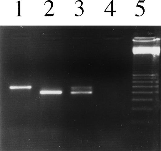 Fig. 4. PCR analysis to detect Igκ transcripts in L1236 cells as well as in H-RS cells of the patient’s affected bone marrow. Lane 1, L1236, DNA; lane 2, L1236 cDNA; lane 3, section of the patient’s affected bone marrow, cDNA; lane 4, no template; lane 5, 100-bp ladder. Using an oligonucleotide hybridizing to the Vκ leader sequence and an oligonucleotide hybridizing to the CDRIII of the rearranged Vκ genes, a specific product was amplified from DNA as well as cDNA. The products differ in length due to splicing of the leader intron. Vκ transcripts were amplified and sequenced from L1236 cells as well as from the bone marrow section. The cDNA of the bone marrow section showed a slight contamination with DNA, resulting in an additional band.