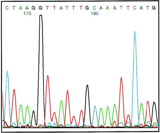 Fig. 5. Primary sequence data obtained from the 5′ untranslated region of the VH1 gene rearrangement of L1236 cells. The VH1 gene rearrangement was amplified using the oligonucleotide 21-2UIS hybridizing to the 5′ region of the VH1 gene rearrangement and the oligonucleotide 3H1 hybridizing to the CDRIII of the VH1 gene rearrangement. Sequencing was performed using the VH1LAS oligonucleotide hybridizing to the leader region resulting in the antisense sequence. The sequence is given above. Numbers indicate the nucleotide positions on the gel. Note that the first position (number 182) of the octamer (number 175 until number 182) is mutated (A→T; for comparison with germline sequence, see also Fig 6).