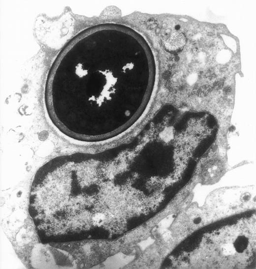 Fig. 7. Electron migrograph of a monocyte that phagocytosed C albicans. A thin section through monocytes following their growth for 24 hours in the presence of 10−7 mol/L jaspamide and their exposure for 30 minutes to C albicans (original magnification × 9,250).