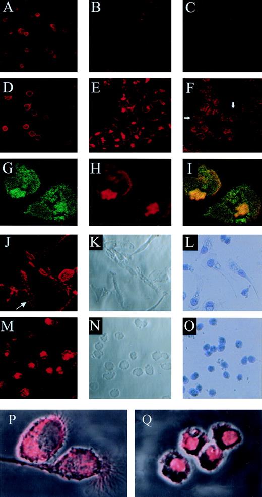 Fig. 3. Competitive binding studies between jaspamide and Rh-phalloidin. Jaspamide induces F-actin aggregation in HL-60 cells and in human monocytes. Competitive studies (A through C). HL-60 cells were stained with Rh-phalloidin in the presence of (A) medium (control). (B) 10−8 mol/L jaspamide and (C) 10−7 mol/L jaspamide; analyzed by CLSM. No actin aggregation is seen. Aggregation of F-actin in HL-60 cells (D through F). HL-60 cells were incubated for 24 hours with (D) medium. (E) 10−7 mol/L jaspamide subsequently washed and stained with Rh-phalloidin (no jaspamide added during staining with Rh-phalloidin). Aggregation of F-actin is seen in (E). (F) HL-60 cells grown for 24 hours in the presence of 3.94 μmol/L CD were stained with Rh-phalloidin (arrows indicate cytochalasin-induced small focal F-actin clusters). Costaining of HL-60 cells with Rh-phalloidin and anti-actin MoAb (G through I). HL-60 cells grown for 24 hours in the presence of 10−7 mol/L jaspamide were costained for F-actin (Rh-phalloidin) and total actin (anti-actin MoAb labeled with anti-mouse–FITC). Colocalization analysis was performed: (G) Actin labeled with anti-actin MoAb (green), (H) F-actin labeled with Rh-phalloidin (red), (I) colocalization of the total actin and F-actin staining is observed (yellow). Effect of jaspamide on monocytes (J through Q). Freshly isolated monocytes were grown for 24 hours in IMDM containing 10% FBS. The cells were incubated for additional 24 hours with the following: (J through L, P) medium; (M through O, Q) 10−7 mol/L jaspamide. (J, M, P, and Q) Monocytes stained with Rh-phalloidin to show the distribution of F-actin. In (P) and (Q) the actin staining (red) is overlaid on the Nomarski image (gray) phase microscopy of the same cells. (L and O) Monocytes stained with Giemsa to show the changes in cell morphology. (A through F: original magnification × 250; G through H: original magnification × 750; J through O: original magnification × 250; P and Q: original magnification × 2,000).