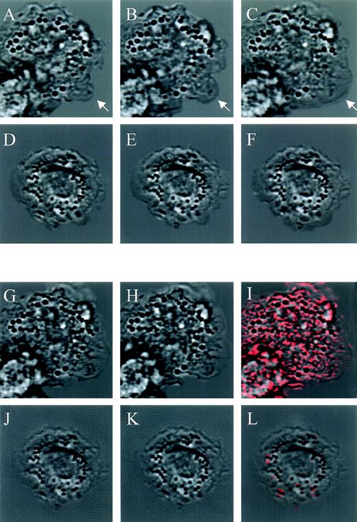 Fig. 5. Effect of jaspamide on intracellular movement and ruffling in monocytes. Nomarski time-lapse photography of monocytes treated for 1 hour with (D through F and J through L) 10−7 mol/L jaspamide compared with (A through C, G through I) untreated cells. Cellular movement (A through F). Nomarski images of a 1-second interval of the (A through C) untreated cells exhibiting movement on the substrate (arrow indicating spreading region); (D through F) jaspamide-treated cells that exhibited no significant movement. Ruffling and intracellular movement: (G through L) 0.05-second interval of treated and untreated cells, after (G and J) 10 minutes and (H and K) 10 minutes + 0.05 seconds were analyzed. Using the CLSM program, we determined the cellular movement that occurred in 0.05 seconds by subtracting the 10-minute images from the images of 10 minute + 0.05 seconds (images 5H minus 5G and images 5K minus 5J) for untreated and treated cells, respectively. The resulting calculation of movement is shown as red areas superimposed on 10-minute + 0.05-second untreated and treated images (I and L, respectively) (original magnification × 1,400).