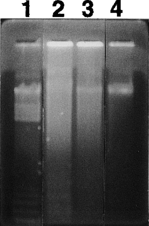 Fig. 3. Effect of RBCs on nucleosomal DNA fragmentation in neutrophils. Neutrophils were cultured for 24 hours in the presence or absence of 1:1000 RBCs. Cells were harvested and DNA fragmentation was analyzed by agarose gel electrophoresis. Lane 1, molecular weight marker; lane 2, cells cultured without RBCs; lane 3, cells cultured with RBCs; lane 4, cells isolated freshly.