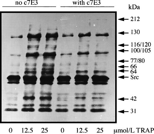 Fig. 1. Washed platelets were preincubated with or without abciximab (10 μg/mL) for 30 minutes before being incubated with two concentrations of TRAP-14 mer under aggregating conditions. Samples were taken at the peak of the aggregation (2 minutes) and platelet proteins were separated by SDS-polyacrylamide gel electrophoresis before the detection of tyrosine-phosphate groups by Western blotting using the monoclonal antibody PY99.