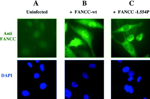 Fig. 1. Cellular localization of the wild-type FANCC protein and the L554P mutant. (A) The HeLa cell line expresses low levels of endogenous FANCC protein that is undetectable by anti-FANCC immunofluorescence. HeLa cells were infected with retroviral supernatants, pMMP-FANCC (B) or pMMP-FANCC-L554P (C). Pools of infected cells were stained with anti FANCC and the DNA-specific dye, DAPI (4′,6-diamidino-2-phenylindole) (bottom images) and analyzed by immunofluorescence, as previously described.4
