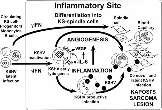 Fig. 1. Inflammatory reactivation and angiogenicity of KSHV/HHV8. A hypothesis for KS pathogenesis emerging from the observations by Aoki et al9 and Monini et al.10 When circulating KS-progenitors and cells latently infected with KSHV home to inflammatory sites, the exposure to ICs such as γIFN causes their differentiation into KS-like spindle cells and induces KSHV reactivation. Reactivation of KSHV could lead to the expression of potentially pathogenic early genes such as vIL-6 that can activate VEGF and induce angiogenesis. Viral lytic replication in the same cells can activate inflammation, which may also play a proangiogenic role. The creation of this inflammatory-angiogenic environment increases the availability of infectable cells such as endothelial cells and KS-spindle cells that will end up in the development of the KS lesion.