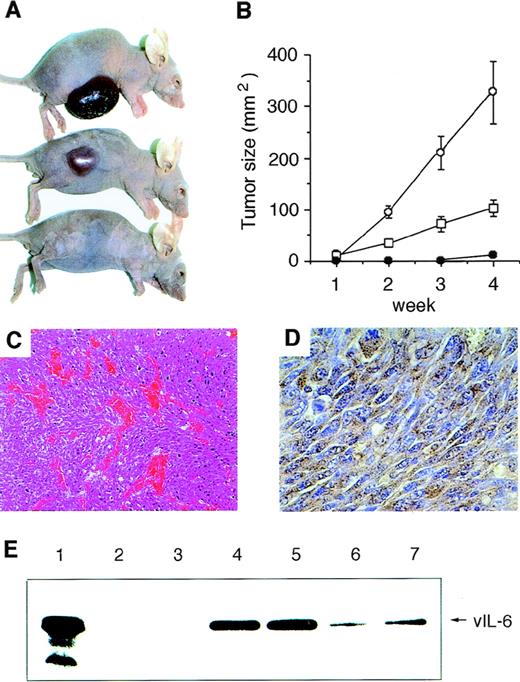 Fig. 2. Tumorigenicity of vIL-6–expressing NIH3T3 cells in nude mice. Cells were injected subcutaneously into the right flanks of 6-week-old female BALB/c nu/nu mice (5 × 105 cells in 100 μL PBS per animal). Five mice were used in each group. (A) Representative mice 4 weeks after injections with v6O (upper), v6H (middle), or BN7 (lower) cells. (B) Tumor growth curves during 4 weeks observation: v6O (○), v6H (□), and BN7 (•). Values reflect the mean (±SD) of tumor size. Time to tumor formation was 5 to 7 days in v6O cells, 5 to 6 days in v6H cells, and 25 to 29 days in BN7 cells, respectively. Data are representative of two independent experiments. (C) Representative microscopic appearance of v6O- and v6H-derived tumor tissues. Abundance of blood vessels in a selected area of tumor tissue is shown (hematoxylin-eosin; original magnification × 100). (D) Immunohistochemical staining of vIL-6 in the tumor tissue from v6O cells (original magnification × 400). (E) vIL-6 detection in sera (0.1 μL) from mice injected with BN7 (lanes 2 and 3), v6O (lanes 4 and 5), and v6H (lanes 6 and 7) cells by Western blotting. Whole cell lysate of v6O cells was used as a positive control (lane 1).