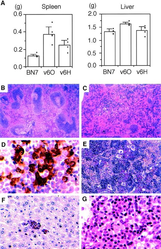 Fig. 3. Effects of vIL-6–expressing cells in nude mice. (A) Spleen and liver sizes of mice injected with control or vIL-6 producing clones. Data reflect the mean (±SD) of the weights of spleens and livers (5 mice in each group). Hematoxylin-eosin stained spleens from (B) a control mouse and (C) a mouse injected with vIL-6–expressing cells (original magnification × 40). (D) Immunohistochemical staining for κ light chains of splenic white pulp (original magnification × 1,000) of a mouse injected with vIL-6–expressing cells showing plasmacytosis. Chloroacetate esterase stained sections show (E) expansion of myeloid cells (stained red), erythroid precursors, and megakaryocytes in the red pulp (original magnification × 200) and (F) myeloid cell islands in the liver (original magnification × 400) in a mouse injected with vIL-6–expressing cells. (G) Hematoxylin-eosin–stained lymph node in a mouse injected with vIL-6–expressing cells (original magnification × 800) showing plasmacytosis.