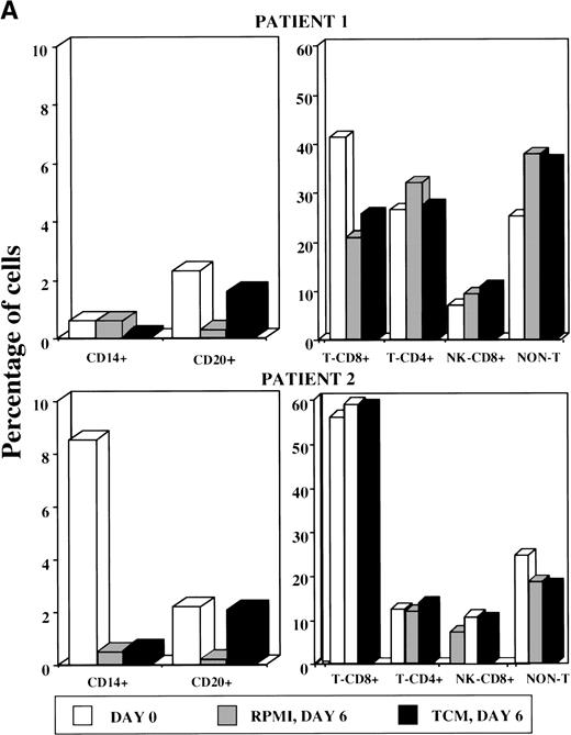 Fig. 4. (A) FACS analysis of PBMC at day 0 and PBMC-derived floating cells cultured for 6 days without TCM (RPMI, day 6) or with TCM (TCM, day 6). T cells were doubly stained for CD3 and CD8 to obtain the percentage of CD8+ T cells (CD3+/CD8+), CD4+ T cells (CD3+/CD8−), CD8+ NK cells (CD3−/CD8+), and non-T cells (CD3−/CD8−). Staining with anti-CD14 and anti-CD20 antibodies was used to identify monocyte and B cells, respectively (left side). Shown are representative examples from 2 patients (upper and lower panels, respectively). Similar results were also obtained with floating cells from other 3 AIDS-KS patients and 1 asymptomatic HIV+ individual analyzed by immunocytochemistry (data not shown). (B) Phenotypic characterization of adherent cells obtained from PBMC of an AIDS-KS patient cultured for 6 days with TCM and analyzed by immunohistochemistry (APAAP method). (a) A representative negative control (isotype-matched control Ab) of adherent cells counterstained by hematoxylin with the typical spindle morphology is shown (original magnification × 400). (b through d) Representative examples of staining for CD68 (b; original magnification × 400), CD14 (c; original magnification × 1,000), and VE-cadherin (d; original magnification × 400) are presented. Nearly 100% of the cells present in these fields showed a specific red staining. The average percentage of positive cells from different fields for all the patients analyzed is shown in Table 5.