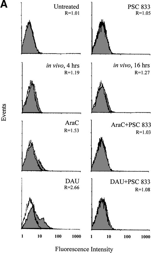 Fig. 3. (A) Flow cytometric analysis of Pgp expression using MRK 16 binding (solid histogram) compared with an IgG2a control (open histogram) in Pgp-negative blasts from a patient with AML undergoing chemotherapy (in vivo) and after ex vivo experiments. Pgp expression was expressed as the ratio of the MCF of MRK 16 versus the IgG2a (R) as described in Materials and Methods. The analysis of samples was performed before treatment (0 h), at 4 hours, and at 16 hours of DAU/AraC treatment. In the ex vivo experiments, cells were exposed for 16 hours to medium alone, to 100 ng/mL DAU in the absence or presence of 1 μmol/L PSC 833, or to 10 ng/mL AraC in the absence or presence of 1 μmol/L PSC 833. (B) Flow cytometric analysis of Pgp function based on Rh123 accumulation in blasts from the same patient as shown in (A) at 0, 4, and 16 hours after DAU/AraC combination chemotherapy (in vivo) and in blasts treated with the same drugs ex vivo. Pgp function was determined by flow cytometric analysis using Rh123 accumulation in the absence (solid histogram) or the presence of 2 μmol/L PSC 833 (open histogram). Pgp function was expressed as the ratio of MCF in the presence or absence of 2 μmol/L PSC 833 as described in Materials and Methods. This ratio (R) is indicated in each case.