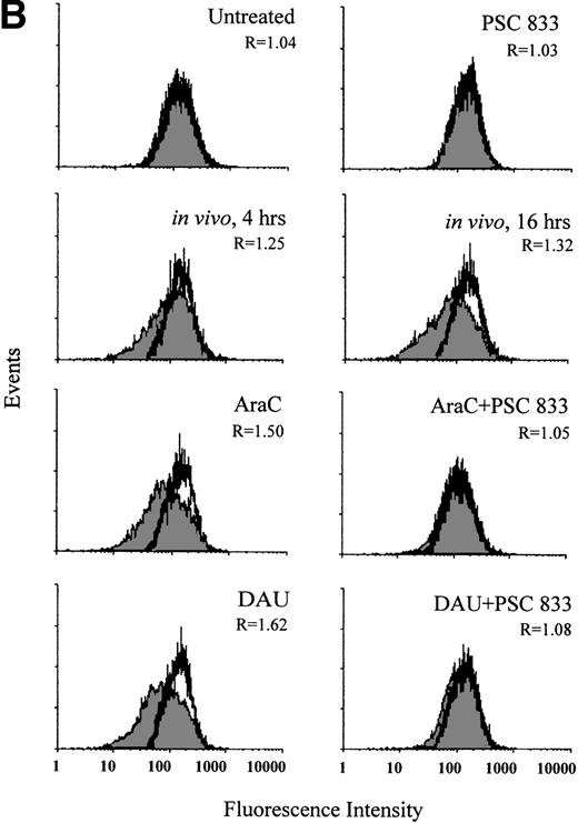 Fig. 3. (A) Flow cytometric analysis of Pgp expression using MRK 16 binding (solid histogram) compared with an IgG2a control (open histogram) in Pgp-negative blasts from a patient with AML undergoing chemotherapy (in vivo) and after ex vivo experiments. Pgp expression was expressed as the ratio of the MCF of MRK 16 versus the IgG2a (R) as described in Materials and Methods. The analysis of samples was performed before treatment (0 h), at 4 hours, and at 16 hours of DAU/AraC treatment. In the ex vivo experiments, cells were exposed for 16 hours to medium alone, to 100 ng/mL DAU in the absence or presence of 1 μmol/L PSC 833, or to 10 ng/mL AraC in the absence or presence of 1 μmol/L PSC 833. (B) Flow cytometric analysis of Pgp function based on Rh123 accumulation in blasts from the same patient as shown in (A) at 0, 4, and 16 hours after DAU/AraC combination chemotherapy (in vivo) and in blasts treated with the same drugs ex vivo. Pgp function was determined by flow cytometric analysis using Rh123 accumulation in the absence (solid histogram) or the presence of 2 μmol/L PSC 833 (open histogram). Pgp function was expressed as the ratio of MCF in the presence or absence of 2 μmol/L PSC 833 as described in Materials and Methods. This ratio (R) is indicated in each case.