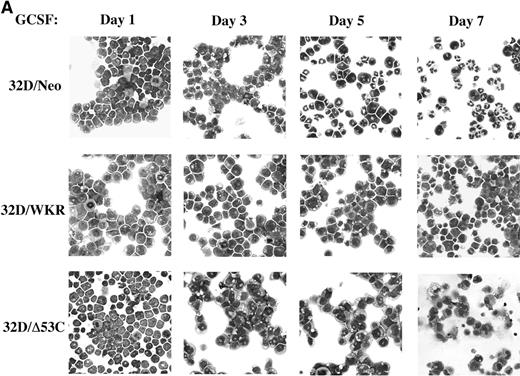 Fig. 8. STAT5A/WKR and STAT5A/▵53C block G-CSF–induced neutrophil differentiation of 32D cells. (A) 32D cells expressing either the neomycin resistance gene alone (32D/Neo), STAT5A/WKR (32D/WKR), or STAT5A/▵53C (32D/▵53C) were placed in 100 ng/mL human recombinant G-CSF and minimal IL-3 to permit cell viability throughout the differentiation assay. Wright-Giemsa–stained cytospins were prepared on the indicated days to assess G-CSF–dependent morphologic maturation of 32D cells. The photographs depicted are representative of at least two independent experiments. (B) Cytospins from day 7 of G-CSF treatment from 32D/Neo and 32D/WRK cells were scored for neutrophil differentiation on the basis of morphology, and the results of three differential counts of 100 cells are each depicted with standard error. (C) 32D/Neo and 32D/WKR cells were analyzed by FACS after staining with anti-CD11b monoclonal antibody (thick line) or isotype control antibody (thin line) on the day before (day 0) and the indicated days after initiation of G-CSF treatment.
