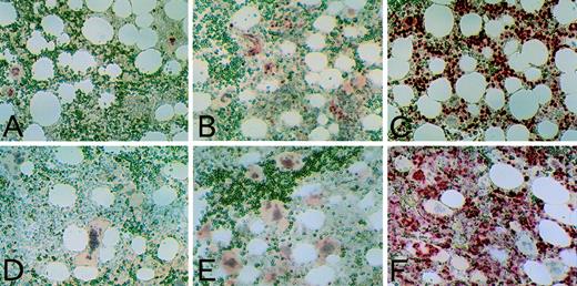 Fig. 5. p21, p27, and Ki-67 staining of BM. Normal BM (A, B, and C) and BM from an ET patient (D, E, and F) was immunostained using anti-p21 antibody, 6B6 (A and D); anti-p27 antibody, G173-524 (B and E); and anti–Ki-67 antibody, MIB1 (C and F). Immunostaining was performed using the APAAP method, as described in Materials and Methods. Positive cells showed red nuclear staining. Although weak cytoplasmic staining in some megakaryocytes was visible when using the MoAb G173-524, it was not reproducible with another antibody F-8 (original magnification × 50).