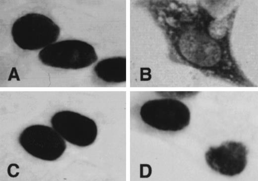 Fig. 5. Subcellular localization of MITF determined by immunocytochemistry. 293T cells were transfected with expression vector containing +-MITF (A), mi-MITF (B), or-MITF (C), orwh-MITF (D) cDNA. After 48 hours of transfection, cells were stained with anti-MITF antibody. (Original magnification × 4,000.)