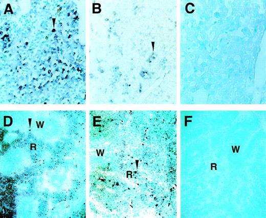 Fig. 2. Hematopoietic cell-specific expression of GATA-2 mRNA in the liver and spleen of embryos and neonates. The expression of GATA-2 mRNA in the fetal liver of 12.5 dpc embryo (A) as well as in the liver of 3-day (B) or 7-day (C) postnatal pups was analyzed by in situ hybridization analysis on tissue sections. In 5-day old pups, GATA-2 mRNA-positive cells were observed in the red pulp but not in the white pulp (R and W, respectively) of the spleen (D and E). The results with antisense (A-E) and sense (F) probes are shown. Arrowheads in panels A, B, D, and E indicate positive cells. Original magnifications are ×64 (A-C, E) and ×20 (D and F).