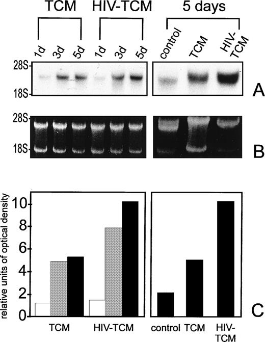 Fig. 2. HIV-TCM increases VEGF-A expression in HUT 78 cells. (A) Northern blot analysis of VEGF-A mRNA expression in HUT 78 cells. Cells were incubated in normal cell culture medium (control) with TCM or HIV-TCM. In two separate experiments, total RNA was isolated after 1, 3, and 5 days of incubation (left) or after 5 days of incubation (right), subjected to electrophoresis (20 μg per lane), and blotted onto a nylon membrane. Hybridization was performed with a radioactively labeled human VEGF-A specific cDNA probe (specific activity, ≥8 × 108 cpm/μg DNA) at 42°C for 16 hours. VEGF-A mRNA expression in HUT 78 cells increased by twofold after 3 and 5 days of incubation with HIV-TCM as compared with TCM and threefold as compared with control cells incubated in normal medium. (B) Ethidium bromide staining of blotted RNA indicated that equal amounts of RNA were used in each lane. (C) Densitometric evaluation of band intensities from the Northern blot shown in (A). RNA derived from cells incubated with TCM or with HIV-TCM were blotted and hybridized on the same filter. VEGF-A expression was similar after 1 day of incubation with HIV-TCM or TCM (□). Increased VEGF-A expression was observed after 3 days (▩) and 5 days (▪) of incubation with HIV-TCM as compared with TCM and standard medium.