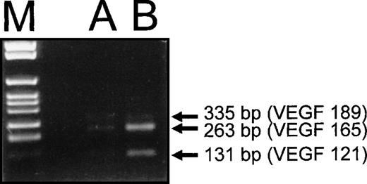 Fig. 5. RT-PCR analysis of VEGF-A mRNA splice variants synthesized by HIV-1–infected HUT 78 cells. RT-PCR was performed with specific primers, which allow discrimination of the different splice variants of VEGF-A mRNA by the length of the polymerization products. As a control, PCR products obtained with cDNA of a human epithelial cell line (A 431) known to produce VEGF-A are shown (A). The two splice variants coding for the secreted forms of VEGF-A, VEGF121and VEGF165 (131- and 263-bp amplification products) and the cell-associated VEGF189 (335 bp) were found to be synthesized in HUT 78 cells infected with HIV-1 (B). The PCR product corresponding to the mRNA splice variant encoding VEGF165was the most prominent, the one corresponding to VEGF121could be detected to a lesser extent, and the one corresponding to VEGF189 was only present in minimal amounts.