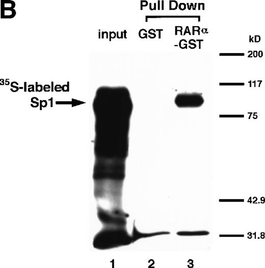 Fig. 5. Physical interaction between RAR/RXR and Sp1. (A) After the mixture of Sp1 plus either RAR or RXR was incubated, respectively, with anti-RAR or RXR antibody at 4°C for 2 hours, proteins were precipitated with protein A-Sepharose, eluted, and analyzed by Western blotting with anti-Sp1 antibody. Lanes 1 through 3, pure proteins; lane 1, Sp1; lane 2, RAR; lane 3, RXR. Lanes 4 through 7, proteins precipitated with anti-RAR or RXR antibody; lane 4, Sp1 preincubated together with RAR and precipitated with anti-RAR antibody; lane 5, Sp1 preincubated together with RXR and precipitated with anti-RXR antibody; lane 6, Sp1 incubated with anti-RAR antibody without RAR; lane 7, Sp1 incubated with anti-RXR antibody without RXR. (B) 35S-labeled Sp1 protein generated by in vitro translation reaction was incubated with GST or RAR-GST immobilized on glutathione-Sepharose beads. After extensive washings, the bound proteins were eluted and subjected to SDS-PAGE followed by autoradiography. Lane 1 input (0.5 μL of the total reaction mixture); lane 2, proteins bound to GST; lane 3, proteins bound to RAR-GST. (C) After the mixture of Sp1 and RAR/RXR was incubated with nonimmune antibody or anti-RXR antibody in BAEC nuclear extracts at 4°C overnight, proteins were precipitated with protein A-Sepharose, eluted, and analyzed by Western blotting with anti-Sp1 antibody. Lane 1, pure Sp1; lane 2, proteins precipitated with nonimmune (NI) antibody; lane 3, proteins precipitated with anti-RXR antibody. (D) BAECs were cotransfected with a combination of Sp1-Gal4 expressing vector (0.125 μg/dish) and Gal4-UAS-luciferase (0.5 μg/dish), plus RAR and/or RXR expressing vectors (250 ng each/dish), along with pRL-CMV (100 ng/dish; Promega) as described before. The day after transfection, the cells were treated or untreated with 1 μmol/L atRA or 9cRA for 12 hours. Luciferase activity of each cell was measured, and relative changes in firefly luciferase activity were plotted after normalization to Renilla luciferase activity. Sample 1, reporter only; sample 2, atRA; sample 3, RAR; sample 4, RAR + atRA; sample 5, RXR; sample 6, RXR + 9cRA; sample 7, RAR and RXR; sample 8, RAR and RXR + atRA; sample 9, RAR and RXR + 9cRA. Each number represents the average ± SD (n = 3). A similar experiment was repeated three times and representative results are shown here.