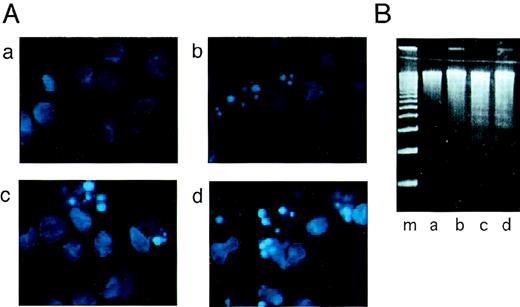 Fig. 1. Induction of HUVEC apoptosis by Sph. (A) Morphological features of HUVEC apoptosis induced by Sph. HUVECs were treated without (a and c) or with (b and d) 20 μmol/L Sph for 4 hours in the presence (a and b) or absence (c and d) of growth factors. Apoptotic cells were detected using Hoechst 33258 staining and visualized with fluorescence microscopy. (B) DNA fragmentation in Sph-treated HUVECs. HUVECs were treated without (lanes a and c) or with (lanes b and d) 20 μmol/L Sph for 4 hours in the presence (a and b) and absence (c and d) of growth factors. Fragmented DNA was isolated and electrophoresed on a 2% agarose gel. DNA was then visualized with ethidium bromide staining. Lane m is a 200-bp DNA ladder.