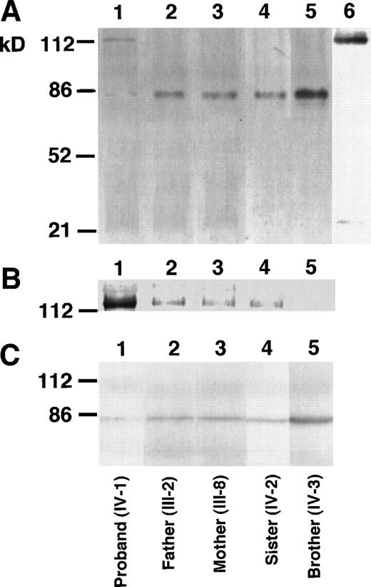Fig. 2. Western blot analysis of the factor XII Tenri family. Factor XII in plasmas of the proband (lane 1), his father (lane 2), mother (lane 3), sister (lane 4), and brother (lane 5) were immunoprecipitated by anti-factor XII antibody. After heat dissociation, immunoprecipitates were electrophoresed on 8% SDS-polyacrylamide gels under nonreducing (A and B) or reducing (C) conditions. Electrophoresed proteins were transferred to polyvinylidene difluoride membranes and then blotted by the biotinylated anti-factor XII antibody followed by avidin-peroxidase. (B) is the overexposure of the high molecular mass region of (A). The sample in lane 6 in (A) was the same as in lane 1, but was blotted by the biotinylated anti-1–microglobulin antibody.