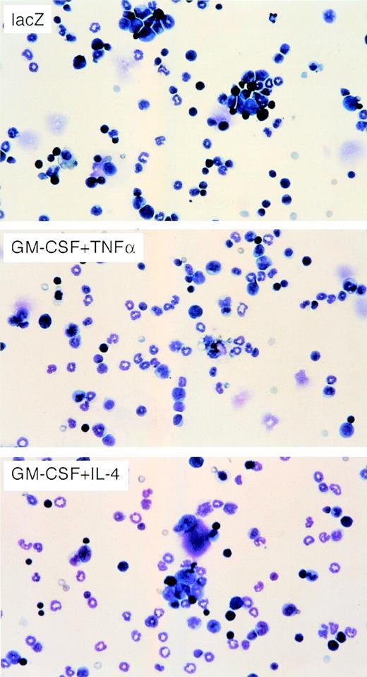 Fig. 4. May-Giemsa stain of BMMNCs from mice injected with WEHI-3B cells expressing exogenous cytokines. BALB/c mice were injected with irradiated WEHI-3B–lacZ, WEHI-3B–GM-CSF plus WEHI-3B–TNF, or WEHI-3B–GM-CSF plus WEHI-3B–IL-4 cells. Seven days later, each BMMNC was analyzed by May-Giemsa stain.