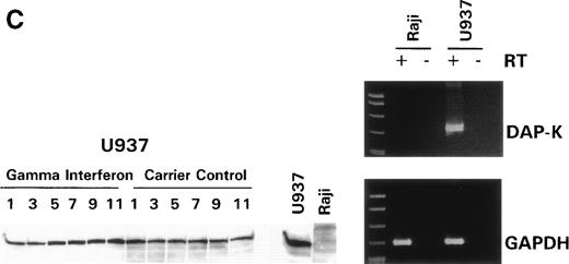 Fig. 2. γ Interferon treatment of cell lines. U937, a leukemia cell line, and Raji, a Burkitt’s lymphoma cell line, were treated with 1,000 U/mL of γ interferon or carrier control for 11 days. (A) U937 cell apoptosis. U937 cells were analyzed for apoptosis on days 3, 5, 7, 9, and 11. U937 cells underwent apoptosis when treated with γ interferon, with significant differences in cell death between treated cells and carrier control cells on each day (P < 10−4). The inset demonstrates U937 cells treated for 5 days with γ interferon or the carrier control; several of the γ interferon-treated cells are undergoing nuclear apoptotic changes (arrowheads point to apoptotic cells), whereas none of the carrier control-treated cells is. (B) Raji cell apoptosis. Raji cells were analyzed for apoptosis on days 3, 5, 7, 9, and 11. Raji cells did not undergo apoptosis when treated with γ interferon or the carrier control. Raji cells treated for 5 days with γ interferon show no cells undergoing apoptosis, and there are no apoptotic nuclei. (C) DAP kinase expression. Cells (106) were lysed on days 1, 3, 5, 7, 9, and 11 of treatment with γ interferon or carrier control before Western analysis. U937 cells exposed to γ interferon upregulated the expression of DAP-Kinase from days 5 through 11. Carrier control cells expressed DAP-Kinase endogenously but did not upregulate the protein expression. Western analysis of U937 and Raji cells and RT-PCR analysis (far right) with GAPDH as controls demonstrate the lack of endogenous expression of DAP-Kinase in Raji at both the RNA and protein levels. DAP-Kinase RT-PCR amplifies a 343-bp product, whereas the GAPDH controls are 310 bp. + and − indicate the addition or the absence of reverse transcriptase (RT), respectively.