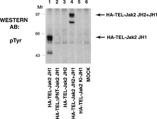 Fig. 2. TEL-Jak2 JH1 and TEL-Jak2 JH2+JH1 are constitutively tyrosine-phosphorylated in COS cells. COS cells were transfected with the constructs as indicated. Fifty micrograms of lysate was resolved via SDS-PAGE and transferred to nitrocellulose. The membrane was incubated with a monoclonal antiphosphotyrosine antibody followed by HRP-sheep antimouse IgG. The position of each tyrosine-phosphorylated protein and molecular weight standards are indicated.