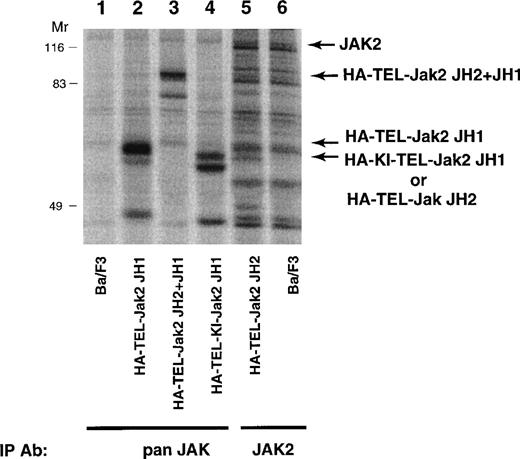 Fig. 3. Expression of TEL-Jak2 fusion proteins in Ba/F3 cells. Ba/F3 (lanes 1 and 6), Ba/F3-HA-TEL-Jak2 JH1 subclone 36 (lane 2), Ba/F3-HA-TEL-Jak2 JH2+JH1 subclone 23 (lane 3), Ba/F3-HA-TEL-KI-Jak2 JH1 subclone 11 (lane 4), and Ba/F3-HA-TEL-Jak2 JH2 subclone 4 (lane 5) were metabolically labeled with35S-cys/35S-met. Immunoprecipitations were conducted with Jak2 antibodies that recognized the Jak2 JH1 domain (pan Jak, lanes 1 through 4) or Jak2 JH2 domain (Jak2, lanes 5 and 6). Immunoreactive species were analyzed via PhosphorImager detection.
