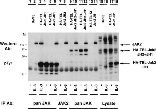 Fig. 5. TEL-Jak2 fusion proteins are constitutively tyrosine-phosphorylated in Ba/F3 cells. Ba/F3 (lanes 1, 2, 15, and 16), Ba/F3 HA-TEL-Jak2 JH1 subclone 18 (lanes 3, 4, 17, and 18), Ba/F3 HA-TEL-Jak2 JH1 subclone 36 (lanes 5 and 6), Ba/F3 HA-TEL-Jak2 JH2 subclone 4 (lanes 7 and 8), Ba/F3 HA-TEL-Jak2 JH2+JH1 subclone 23 (lanes 9 and 10), Ba/F3 HA-TEL-Jak2 JH2+JH1 subclone 31 (lanes 11 and 12), and Ba/F3 HA-TEL-KI-Jak2 subclone 11 (lanes 13 and 14) cells were depleted of cytokine and stimulated in the presence or absence of IL-3. Lysates were immunoprecipitated with an antibody that recognizes the Jak2 JH1 domain (pan Jak, lanes 1 through 6 and 9 through 14) or the Jak2 JH2 domain (Jak2, lanes 7 and 8) and tyrosine-phosphorylated proteins were detected by immunoblotting with a monoclonal antiphosphotyrosine antibody. Lysate controls are shown in lanes 15 through 18. The mobility of tyrosine-phosphorylated Jak2, HA-TEL-Jak2 JH1, and HA-TEL-Jak2 JH2+JH1 are indicated.
