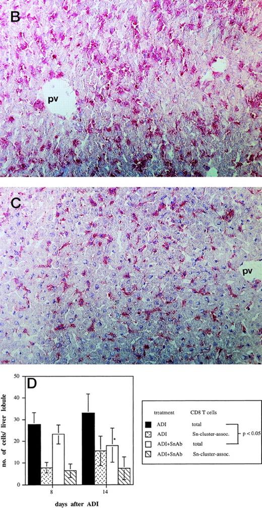 Fig. 4. Effect of the treatment with anti-Sn MoAbs in vivo on the efficiency of ADI therapy in tumor-bearing DBA/2 mice. (A) Tumor-bearing mice (6 animals per experimental group) were treated IV with the mixture of anti-Sn MoAbs (1C2 and SER-4 directed against different epitopes of Sn) 1 and 3 days after ADI. (▪) Control (nontreated tumor-bearing mice); (□) ADI-treated tumor-bearing mice; (▴) tumor-bearing mice injected with anti-Sn MoAbs 1 and 3 days after ADI; (•) tumor-bearing mice injected with normal rat IgG (control Abs). One representative experiment of three is shown. (B and C) Immunohistochemical pictures of frozen liver sections from tumor-bearing DBA/2 mice (at day 8 after ADI) treated with immune cells only (B) or in combination with the mixture of anti-Sn MoAbs (1C2 and SER-4) (C). Shown are periportal areas in which most of the Sn+ macrophages are located. (B) shows the staining for Sn (pink) and (C) shows the staining for anti-Sn MoAbs (pink) using goat antirat second antibody (original magnification × 200). pv, portal vein. (D) Presence of CD8 T lymphocytes in the livers of mice treated with ADI and anti-Sn MoAbs. Total number of CD8 T cells in ADI-treated mice (▪) and in animals injected with anti-Sn MoAbs 1 and 3 days after ADI (□). Number of CD8 T cells associated with Sn+ Kupffer cells in clusters in mice treated with ADI only () or with ADI in combination with anti-Sn MoAbs (▧). Data represent the means and standard deviations from two experiments with 2 to 3 animals per time point. *Statistically significant difference when compared with the respective control.