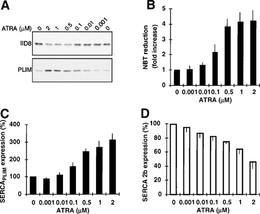 Fig. 2. Concentration dependence of ATRA-induced modulation of calcium pump expression. HL-60 cells were treated for 4 days with various concentrations of ATRA and calcium pump expression; NBT reduction by the cells was also determined. (A) Immunostaining for SERCA 2b and SERCAPLIM with the IID8 and PLIM430 antibodies, respectively. (B) NADPH oxidase activity of the cells as measured by NBT reduction. (C and D) Densitometric analysis of SERCAPLIM and SERCA 2b expression. Data represent the mean ± SEM of 5 experiments.