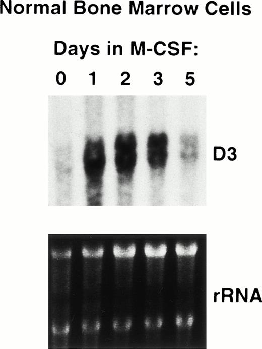 Fig. 4. Induction of D3 expression in differentiating bone marrow macrophages. RNA was extracted from normal BMC treated 0 to 5 days in M-CSF in vitro as described in Materials and Methods. RNA was analyzed on Northern blots, which were probed with D3 (top), and equal loading of RNA samples was verified by ethidium bromide staining of rRNA (bottom).