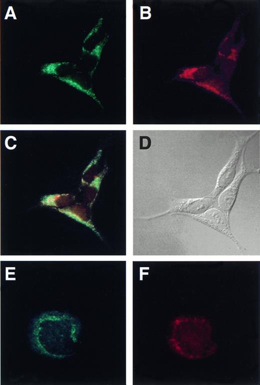 Fig. 4. Human cellubrevin colocalizes with the transferrin receptor in HEK-293 cells and is present in megakaryocytes. HEK-293 cells were fixed with methanol and incubated with (A) anti-Hceb antibody (1/25), FITC-conjugated antirabbit antibody (1/150); (B) antitransferrin receptor antibody (1/25), Texas Red-conjugated antimouse antibody (1/150); (C) overlap of (A) and (B), which was generated with Adobe Photoshop 5.0; (D) differential interference contrast microscopy (DIC) image of the same cells. Original magnification 600×. Megakaryocytes were fixed with 3.7% formaldehyde, permeabilized with 100 μg/mL digitonin and incubated with (E) anti-Hceb antibody (1/25), FITC-conjugated antirabbit antibody (1/150); (F) anti-gpIIβ/III antibody (1/100), Texas Red-conjugated antimouse antibody (1/150). Original magnification 1,000×.