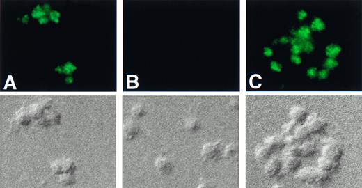 Fig. 6. Immunofluorescence studies of human cellubrevin in platelets. Platelets were fixed with 3.7% formaldehyde and permeabilized with 100 μg/mL digitonin. The cells were then incubated with (A) anti-Hceb antibody (1/5) followed by FITC-conjugated antirabbit antibody (1/150); (B) anti-Hceb antibody that had been preincubated with 200 μg of GST-Hceb recombinant protein followed by FITC-conjugated antirabbit antibody (1/150); (C) anti-Hceb antibody that had been preincubated with 200 μg of GST-VAMP 2 recombinant protein followed by FITC-conjugated antirabbit antibody (1/150). A DIC image of each panel is included below. Original magnification 2,800×.