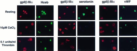Fig. 7. Human cellubrevin staining remains intracellular in surface-activated platelets. Platelets were prepared as resting (see Materials and Methods) or surface-stimulated in the presence of 10 μmol/L CaCl2 or 10 μmol/L CaCl2 and 0.1 U/mL thrombin. Platelets were fixed with 3.7% formaldehyde and permeabilized with 100 μg/mL digitonin. Left panel, anti-gpIIβ/III antibody (1/100), Texas Red-conjugated antimouse antibody (1/150) (gpIIβ/III); anti-Hceb antibody (1/25), FITC-conjugated antirabbit antibody (1/150) (Hceb). Middle panel, anti-gpIIβ/III antibody (1/100), Texas Red-conjugated antimouse antibody (1/150) (gpIIβ/III); antiserotonin antibody (1/10), FITC-conjugated antirabbit antibody (1/150) (serotonin). Right panel, anti-gpIIβ/III antibody (1/100), Texas Red-conjugated antimouse antibody (1/150) (gpIIβ/III); anti-vWF antibody (1-500), FITC-conjugated antirabbit antibody (1/500) (vWF). Original magnification 2,800×.