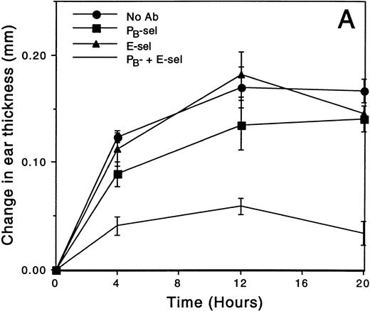 Fig. 2. The effect of MoAb treatment on croton oil-induced ear swelling throughout the response. (A) The change in ear swelling of L-selectin–deficient mice. At each time point, mice treated with combined anti-PB plus anti–E-selectin are significantly different from each of the other treatment groups (all pairwise comparisons P < .001). (B) The change in ear swelling of wild-type mice. Anti-PB- plus anti–E-selectin inhibits ear swelling at each time point (P < .005 compared with no antibody control), whereas anti–L-selectin has no effect. Data are from a representative experiment (n ≥ 3 mice/time point).
