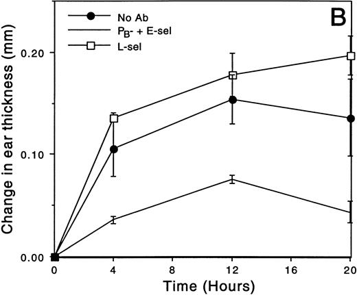 Fig. 2. The effect of MoAb treatment on croton oil-induced ear swelling throughout the response. (A) The change in ear swelling of L-selectin–deficient mice. At each time point, mice treated with combined anti-PB plus anti–E-selectin are significantly different from each of the other treatment groups (all pairwise comparisons P < .001). (B) The change in ear swelling of wild-type mice. Anti-PB- plus anti–E-selectin inhibits ear swelling at each time point (P < .005 compared with no antibody control), whereas anti–L-selectin has no effect. Data are from a representative experiment (n ≥ 3 mice/time point).