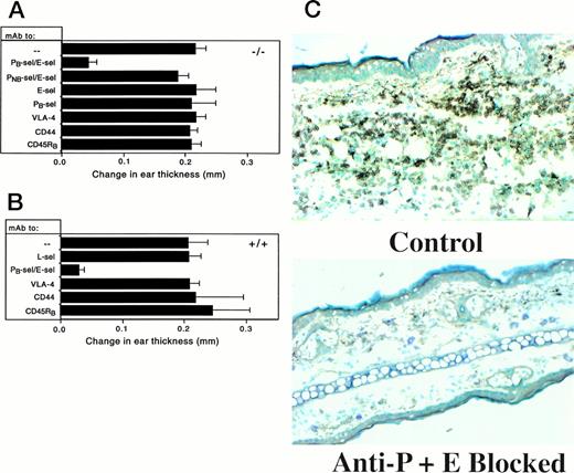 Fig. 1. Change in ear swelling induced in L-selectin–deficient (A) and wild-type (B) mice by the nonspecific irritant croton oil. Sixteen hours after croton oil application, the combination of blocking anti–P-selectin (PB) plus anti–E-selectin was able to significantly reduce ear swelling in both strains of animals (P< .001 compared with no antibody). Nonblocking anti–P-selectin (PNB) in combination with anti–E-selectin had no effect. L-selectin–deficient mice had ear swelling comparable to that of wild-type animals and anti–L-selectin treatment had no effect on ear swelling in +/+ mice. Each treatment group contained ≥5 animals. (C) Neutrophil infiltrate into croton oil-treated ears is blocked by anti–P-plus anti–E-selectin. Sixteen hours after the application of croton oil to ears of wild-type mice, immunohistochemical staining of ear sections with anti–GR-1 was performed. Cells stained brown are positive for the marker (original magnification × 400). Combined anti-endothelial selectin antibodies show a substantial diminution of both GR-1 staining and ear swelling. L-selectin–deficient mice treated in the same manner showed identical staining patterns (data not shown).