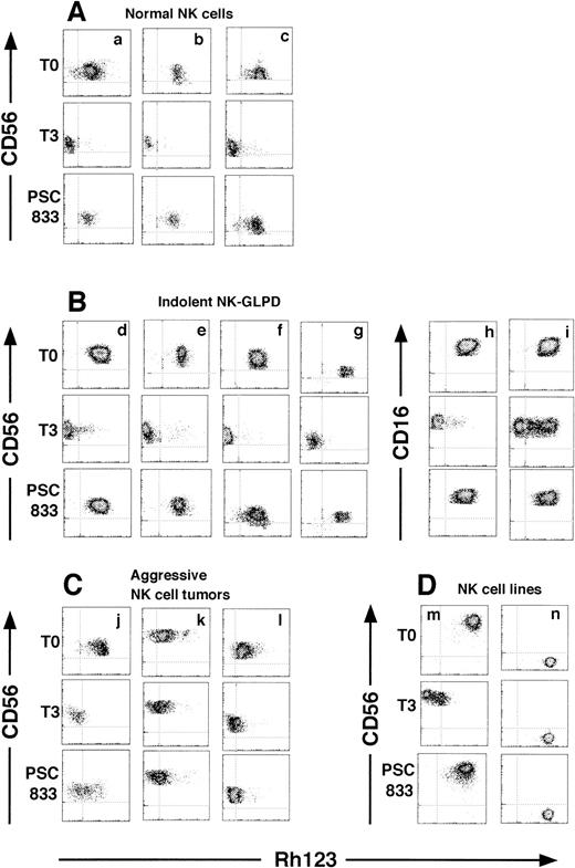 Fig. 2. Two-dimensional flow cytometric dot plots of a three-color flow cytometric assay of NK cells stained with CD16 and CD56 after Rh123 efflux, gating on CD16+ or CD56+ populations. (A, B, C, and D) are NK cells from the normal donors, indolent NK-GLPD, aggressive NK cell tumors, and NK cell lines, respectively. (d through l) correspond to patients 1 through 9 of Table 1, respectively. (m) is the cell line NK92, and (n) is the cell line NKL. Dot density maps stained with Rh123 (T0), after the 3-hour efflux period without inhibitors (T3), and with 1 μmol/L PSC833 (PSC833). The results with 1 μmol/L CsA are similar to those with 1 μmol/L PSC833 and are omitted.