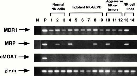 Fig. 3. Analysis of mRNA expression of MDR1, MRP, cMOAT and β2m genes using RT-PCR. Lane (N) is negative control, without cDNA, and lane (P) is positive controls, K562/ADM for MDR1 and β2m, HepG2 for MRP and cMOAT. Lanes 1 through 3, 4 through 9, 10 through 12 and 13 through 14 are NK cells from the normal donors, indolent NK-GLPD, aggressive NK cell tumors, and NK cell lines, respectively. Lanes 4 through 12 correspond to patients 1 through 9 of Table 1, respectively. Lane 13 is the cell line NK92, and lane 14 is the cell line NKL.