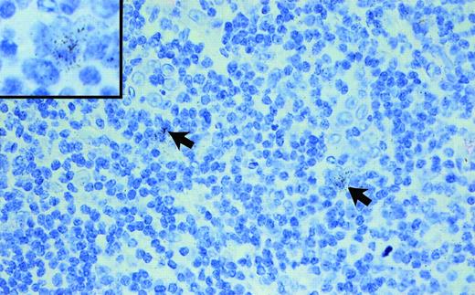 Fig. 1. Hyperplastic tonsil hybridized with a TRAF1 antisense probe (exposure, 6 weeks; original magnification × 250; original magnification of the insert × 900). Note the few faintly TRAF1+ lymphoid blasts (arrows and insert).