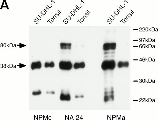 Fig. 1. Western blotting reactivity of monoclonal anti-NPM antibodies. (A) Wild-type NPM (38 kD) is detected in lysates of both normal cells (tonsil) and of the t(2;5)-positive cell line SU-DHL-1 with each of the three antibodies. However, only the two antibodies to the N-terminal region (NA24 and NPMa) react with the hybrid NPM-ALK protein (80 kD). (B) The two antibodies to the N-terminal region (NA24 and NPMa) detect recombinant NPM-ALK and also recombinant NPM-MLF1 and NPM-RAR proteins. Antibody NPMc (against the C-terminal region) is unreactive with any of these fusion proteins.