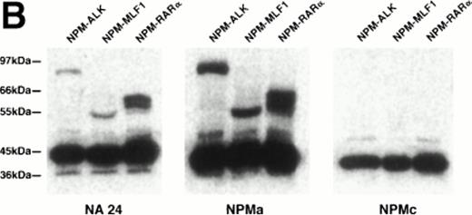 Fig. 1. Western blotting reactivity of monoclonal anti-NPM antibodies. (A) Wild-type NPM (38 kD) is detected in lysates of both normal cells (tonsil) and of the t(2;5)-positive cell line SU-DHL-1 with each of the three antibodies. However, only the two antibodies to the N-terminal region (NA24 and NPMa) react with the hybrid NPM-ALK protein (80 kD). (B) The two antibodies to the N-terminal region (NA24 and NPMa) detect recombinant NPM-ALK and also recombinant NPM-MLF1 and NPM-RAR proteins. Antibody NPMc (against the C-terminal region) is unreactive with any of these fusion proteins.