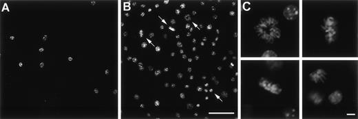 Fig. 4. In vitro proliferation of murine AM after infection withAdmGM-CSF. AM were plated on cell locator dishes and infected with AdmGM-CSF or AdNull, each at 200 moi. The AM were fixed 96 hours later, and the nuclei were stained with DAPI and evaluated using fluorescence microscopy. (A) AdNull. (B) AdmGM-CSF; note the marked increase in the number of cells. Arrows indicate mitotic figures. (C) AdmGM-CSF, mitotic figures from (B) shown at higher magnification. Bar = 50 μm for (A) and (B); bar = 5 μm for (C).