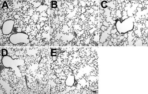 Fig. 10. Lung histology after in vitro infection of AM by AdmGM-CSF or AdNull and subsequent transfer of the genetically modified AM to the lung. Shown is light microscopy of hematoxylin/eosin-stained sections of formalin fixed lung 1 and 5 weeks after AM transfer. (A) Naive mice. (B) Mice receiving AM modified with AdNull 1 week previously. (C) Mice receiving AM modified with AdmGM-CSF 1 week previously. (D) Similar to (B), but after 5 weeks. (E) Similar to (C), but after 5 weeks. Bar = 100 μm.